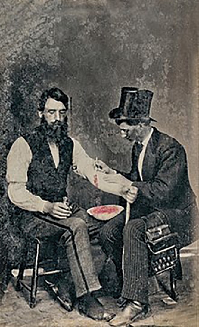 The Victorian art of bloodletting